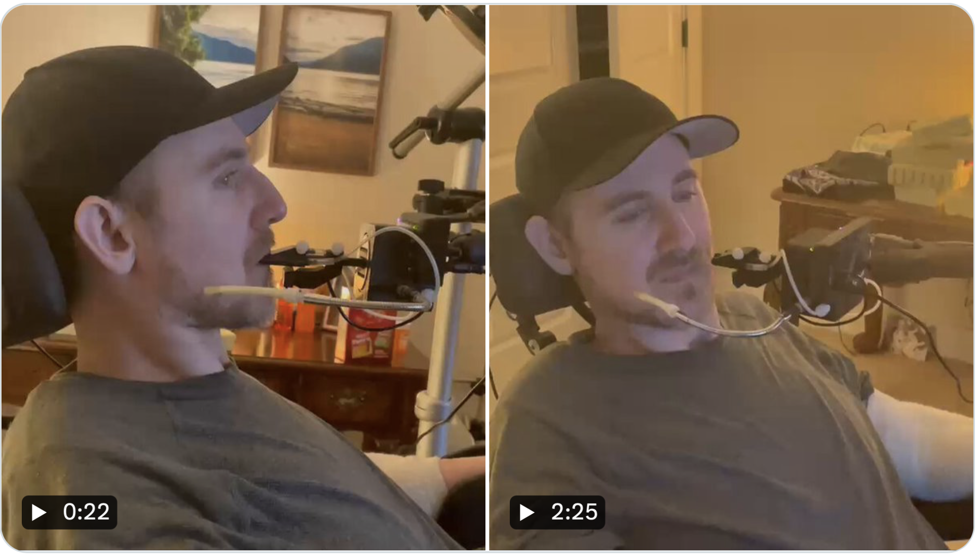 Парализованный участник тестов Neuralink смог управлять игрой Battlefield 6 силой мысли