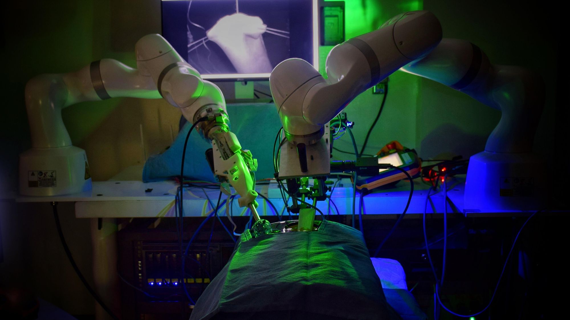 Как экспериментальный робот-хирург может работать без помощи человека