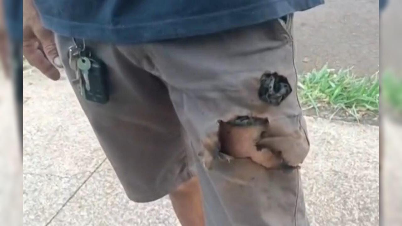 Взорвавшийся в кармане смартфон спас жизнь бразильцу