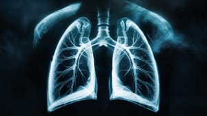 В Москве будут использовать искусственный интеллект для расшифровки рентгеновских снимков