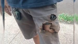 Взорвавшийся в кармане смартфон спас жизнь бразильцу