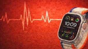 Apple повторно обязали выплатить Masimo $634 млн